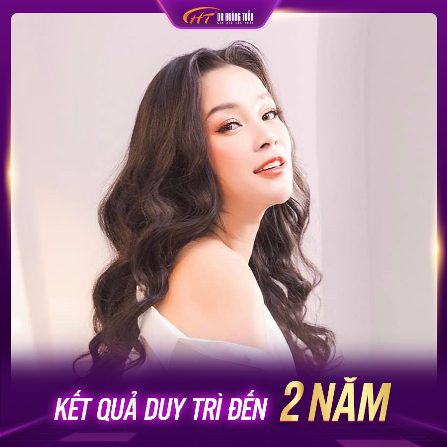 thermage giữ được bao lâu